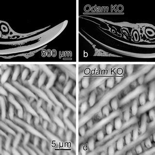 Backscatter scanning electron microscopy (BEI) of 6-months old WT (a ...