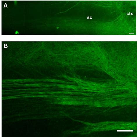 Figure From Axonal Regeneration In Hippocampal And Spinal Cord