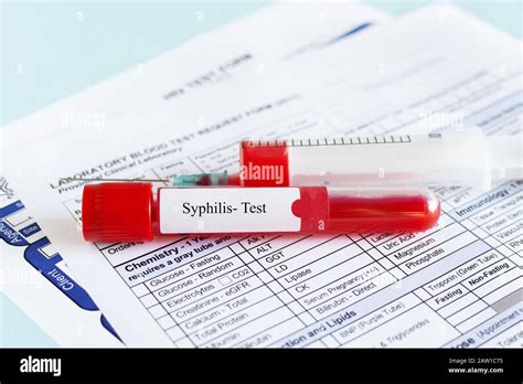 Syphilis Hi Res Stock Photography And Images Alamy