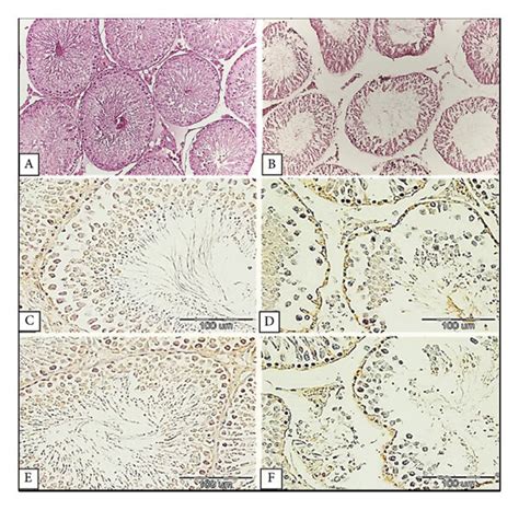 (a) Testicular histology and immunohistochemical findings in sham and ...