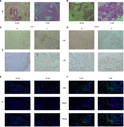 Frontiers Unveiling The Role Of Regulatory T Cells In The Tumor