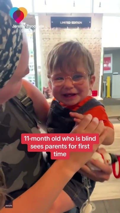 Legally Blind 11 Month Old Sees Parents For First Time With Special