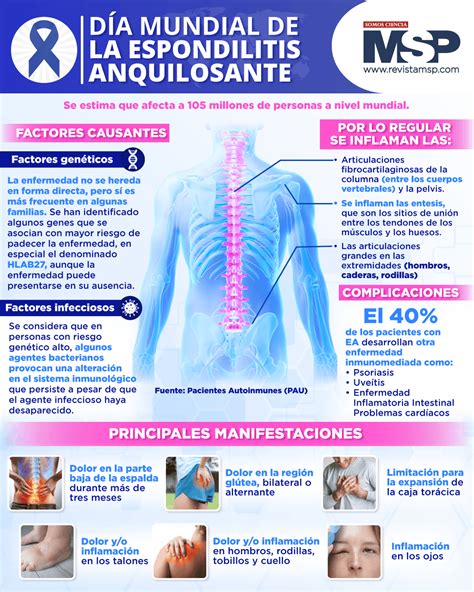 Día mundial de la espondilitis anquilosante