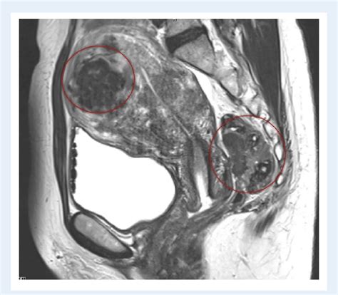 Pelvic Anatomy Mri Human Anatomy