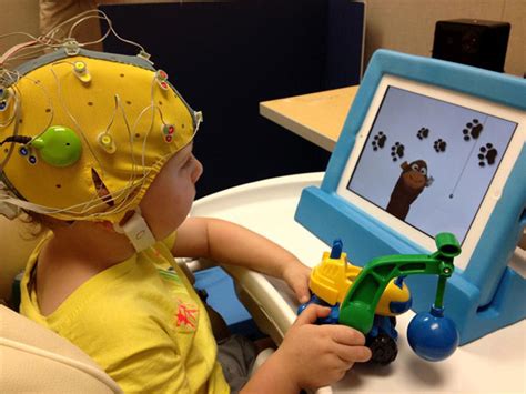 How cochlear implants help profoundly deaf children | University of ...