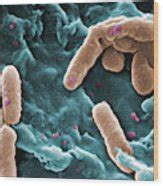 Mdr Pathogen Pseudomonas Aeruginosa Photograph By Science Source