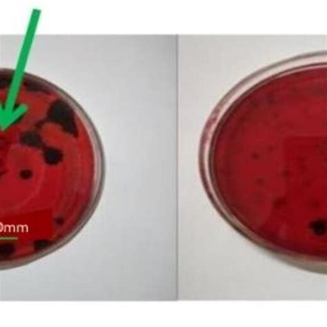 Plates Showing Clearing Zones In Carboxy Methyl Cellulose Cmc Agar