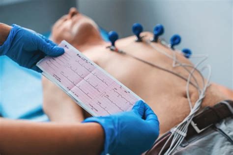 Electrocardiograma ECG qué es cómo leerlo y para qué sirve Tua Saúde