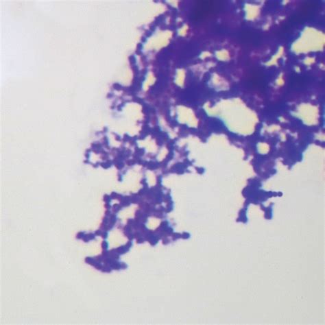 Streptococcus, w.m. Microscope Slide | Carolina Biological Supply