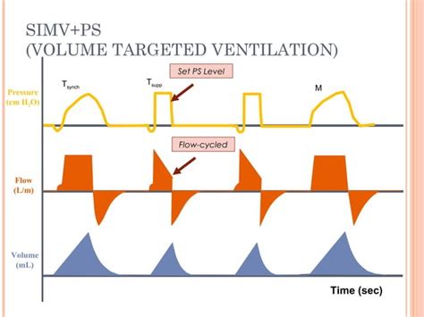 Basic ventilatory modes