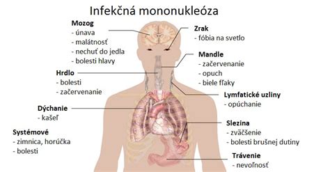 Infekčná mononukleóza