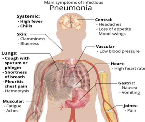 Clin Med Ii Pneumonia Flashcards Quizlet