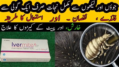 Sar Ki Juen Khatam Karne Ka Tarika Head Lice Removal Juon Likho Ka