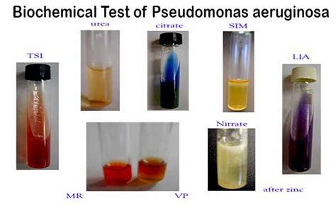 Biochemical Test and Identification of Pseudomonas aeruginosa