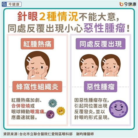 6種人超會長針眼！「有1情況」恐是癌 拉眼皮有用嗎？醫解答了 Ettoday健康雲 Ettoday新聞雲