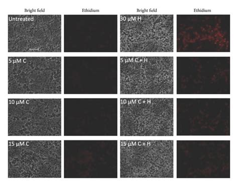 Effect Of Curcumin C Pretreatment On Hemin H Induced Reactive