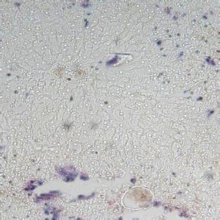 Photomicrograph Of Section Of Liver Architecture Showing CCl4 Toxic