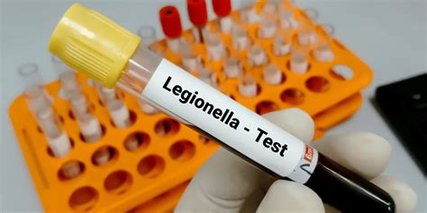 Blog Legionella w wodzie Co musisz wiedzieć Jakie filtry usuwają