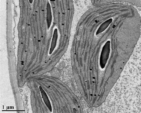 Plant Cells Under An Electron Microscope