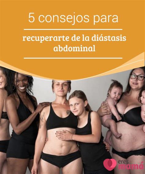 5 consejos para recuperarte de la diástasis abdominal Embarazo post