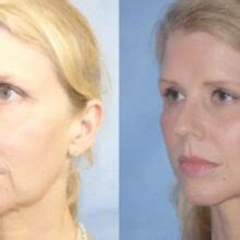Reverse Your Biological Age with Diet, Exercise, Sleep and Stress ...