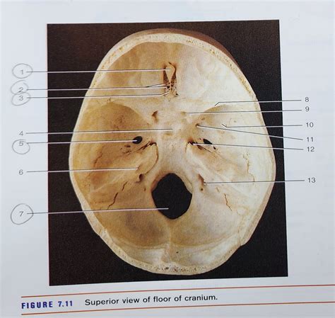 Superior View Of Floor Of Cranium Diagram Quizlet