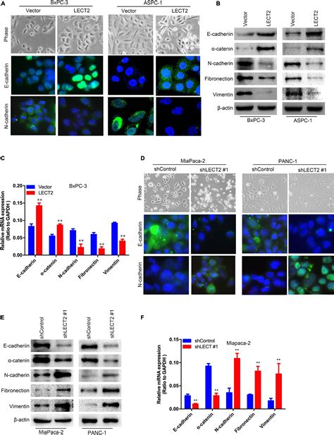 Frontiers Lect Antagonizes Foxm Signaling Via Inhibiting Met To