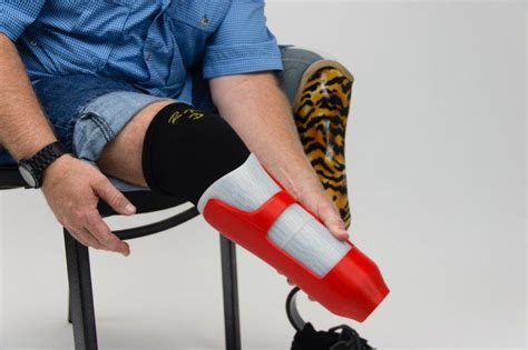 A Man With A 3d Printed Composite Prosthetic Socket Made On The Mark