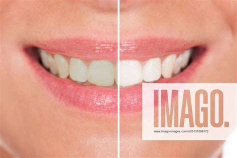 Smiling Woman With Perfect White Teeth Model Released Symbolfoto