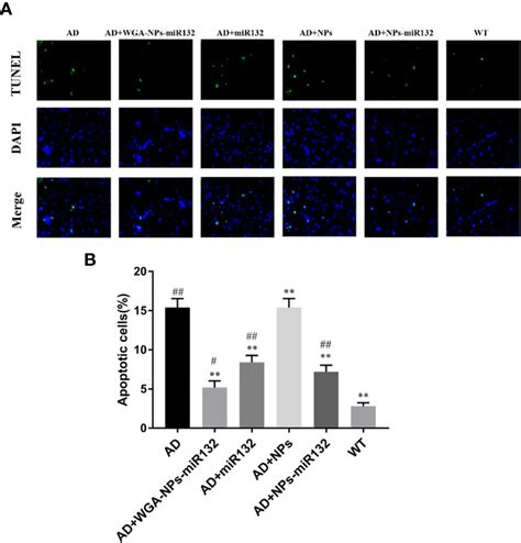 Frontiers Intranasal Delivery Of Targeted Nanoparticles Loaded With