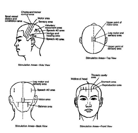 9 best TCM Scalp Acupuncture images on Pinterest | Acupuncture ...