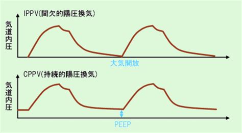 Peepとは何か、いくらに設定すればよいのか とある内科医の雑記帳