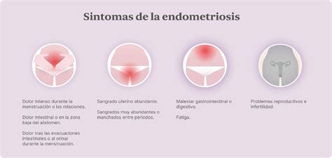 Endometriosis Claves Para Entender La Enfermedad Next Fertility