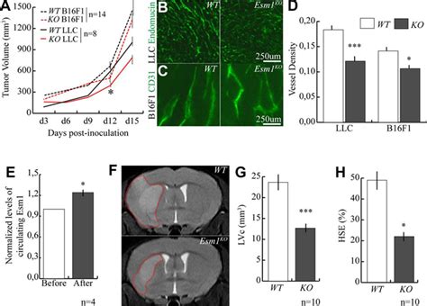 Esm Modulates Endothelial Tip Cell Behavior And Vascular Permeability