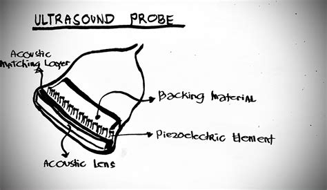 Ultrasound Transducer Informacionpublica Svet Gob Gt