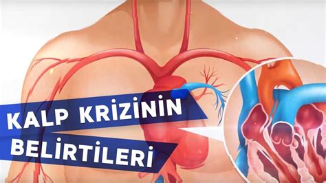 Kalp Krizinin Belirtileri Nelerdir kalpkrizi tedavi sağlık YouTube