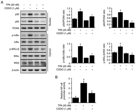 CDDO a PPARγ ligand inhibits TPAinduced cell migration and invasion