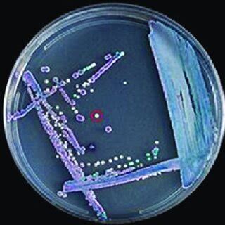 Pink Colonies Of Candida Auris On Chrom Agar Source Cdc Gov