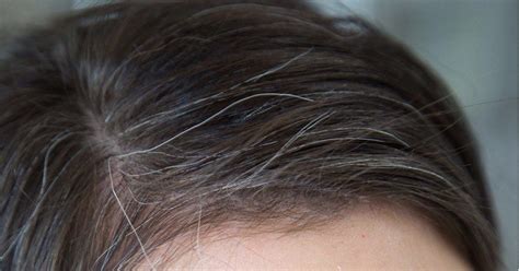 Natural Ways To Deal With Premature Greying Of Hair