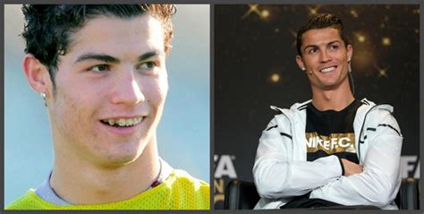 Cristiano Ronaldo Dientes antes y después una selección de fotos