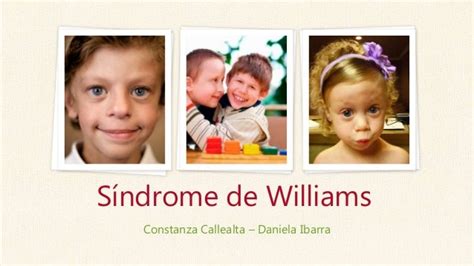 Síndrome De Williams