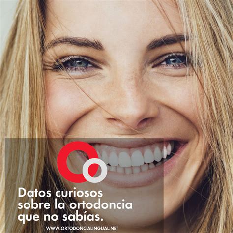 10 datos curiosos sobre la ortodoncia que no sabías Clínicas Ana