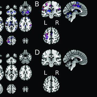 Group Level GLM Activation Maps Showing Unique Brain Activation Spatial