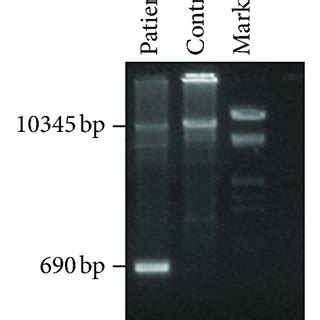 MLPA Analysis Reveals A Candidate Genomic Rearrangement In The MSH2