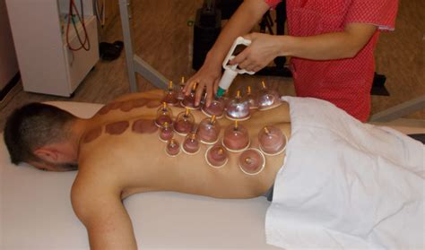 Terapia Cu Ventuze Equilibrium Therapy