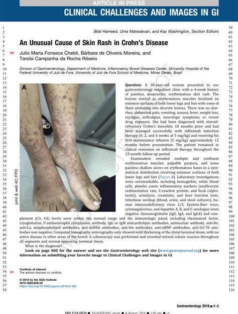 Pdf An Unusual Cause Of Skin Rash In Crohns Disease