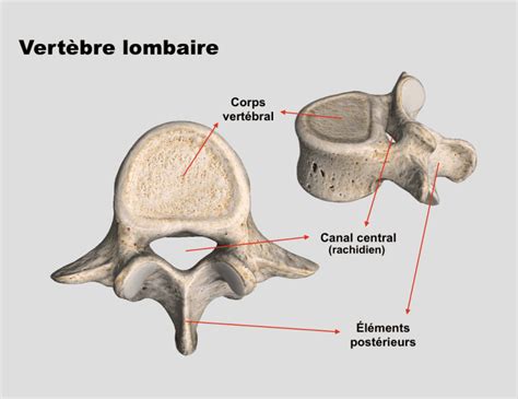 Sténose Spinale Causes symptômes et traitement Chiro à Québec