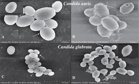 Scanning Electron Microscopy Of Planktonic Cells Of Candida Glabrata