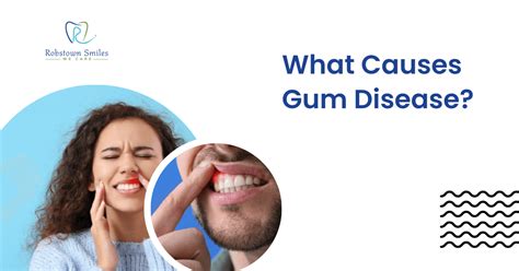 What Causes Gum Disease and How to Prevent It | Robstown Smiles