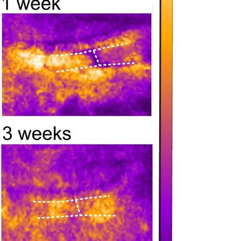 Representative laser speckle contrast imaging (LSCI) from 1 patient who ...